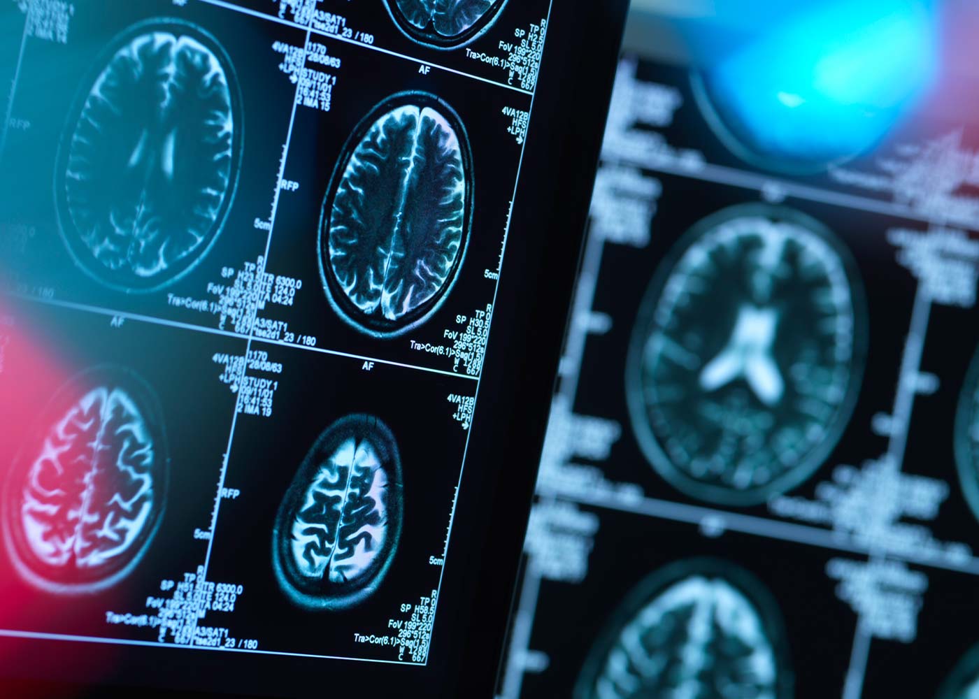 TREC DC - an image showing an x-ray of brain activity